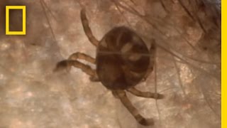 Dangerous Deer Ticks  National Geographic [upl. by Sudbury]