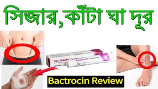 Bactrocin Ointment Cream Review  Easy Way To Get Rid of Thorns [upl. by Eiramrebma]