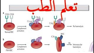 paroxysmal nocturnal hemoglobinuria PNH [upl. by Leola]