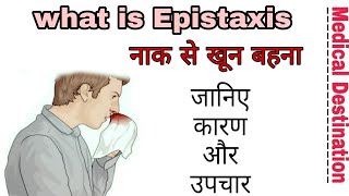 Epistaxis in hindi  Medical destination [upl. by Feld]