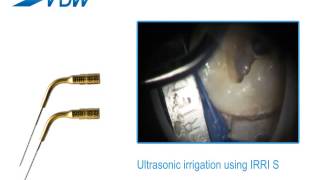 VDW Dental · How To VDWULTRA  Ultrasonic irrigation using IRRI S [upl. by Votaw343]