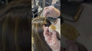 Hair alopecia treatment ❤️😇 treatment alopeciaareatatreatment hairstyle alopeciahairloss [upl. by Drareg]