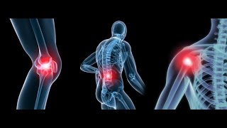 Treatment for Osteoarthritis [upl. by Euqnimod669]