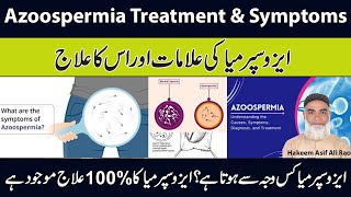 Azoospermia Treatment amp Symptoms  Azoospermia Ka Ilaj Aur Is KI Alamaat [upl. by Itaws]