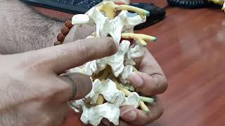 समझे Spondylolysis क्या होता है What is spondylolysis [upl. by Cinderella]