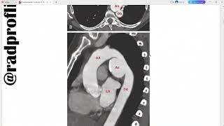 FUNDAMENTALS OF BODY CT [upl. by Eldwun]