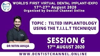 Tilted Implantology using The T I I L T Technique Dr Nitin Ahuja  Session 6 [upl. by Icak]