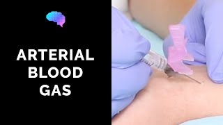 How to take an arterial blood gas ABG  OSCE guide  UKMLA  CPSA [upl. by Aissila]