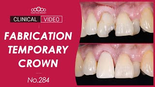 11 crown preparation and Temporary crown setting Dr Na Kiwon [upl. by Otrevire]