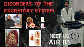 Disorders of the Excretory System [upl. by Ezalb]