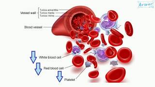 pancytopenia English  Medical terminology for medical students [upl. by Adiasteb728]