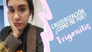 TRIGONITIS  Cauterización de vejiga mi experiencia [upl. by Ivie297]