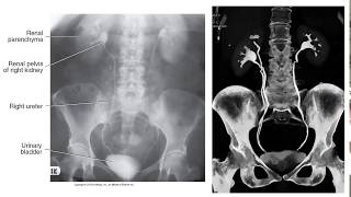 Radiographic Contrast Studies of the Urinary System [upl. by Danielson]