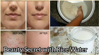 Get The Most Beautiful Skin With This Super Easy Rice Water Toner That Contains TONS Of VITAMIN [upl. by Nainatrad]