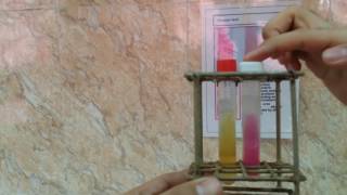 Urease test [upl. by Fidelas]