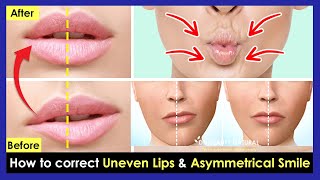 How to correct Uneven Lips Crooked Lips Asymmetrical smile by Facial amp Lips Exercises [upl. by Yttik]