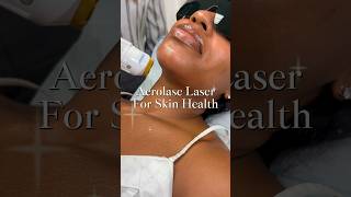 AEROLASE For Skin Health ✨Laser services should be in your skin care [upl. by Mireille]