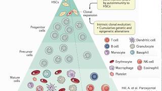 Paroxysmal Nocturnal Hemoglobinuria Whats on the Horizon 2018 [upl. by Naid33]