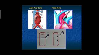 Intraoperative Monitoring part2 DrDoaa Kamal [upl. by Coney236]