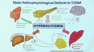 Making Sense of Diabetic Medications [upl. by Nnylav311]