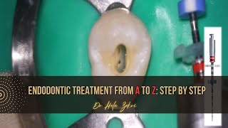 Root canal treatment from A to Z Step by Step [upl. by Anidam]