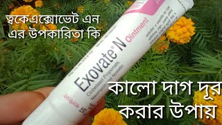 Exovate N ointmentত্বক ফর্সা করবে কিনা  Exovate N ointment ত্বকে এর কাজ কি [upl. by Zampardi]