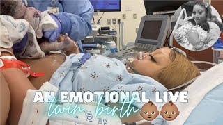 THE LIVE BIRTH OF OUR SECOND SET OF TWINS  Real Raw amp Emotional Doctor Turns Breech Baby in Womb [upl. by Navis]