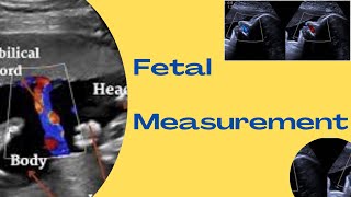 Fetal Measurements  Fetal Biometry  Basic Fetal Ultrasound Examination [upl. by Atiuqam]