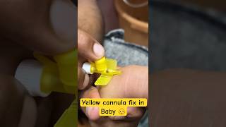 Yellow cannula fix in baby 👶  cannula cannulation trending shorts new SMpharmacy [upl. by Heck83]