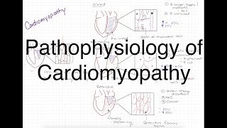 Pathophysiology of Cardiomyopathy [upl. by Victor]