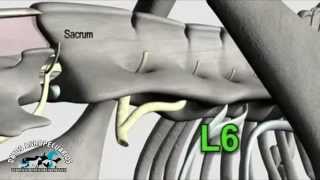 Anestesia epidural en Bovinos [upl. by Noellyn]