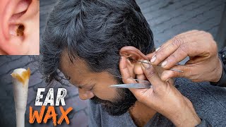 Wax Removal Inside Ear  Dirtiest Ear Cleaning on Street  Indian Street Ear Cleaner [upl. by Amsed712]