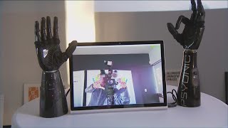 Start up builds prosthetic bionic hand of the future [upl. by Silvain538]