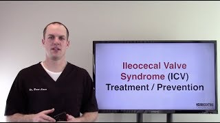 Ileocecal Valve Syndrome Symptoms [upl. by Annauj920]