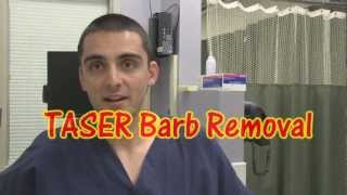 TASER Barb Removal [upl. by Austen]