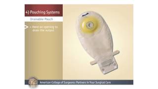 ColostomyIleostomy Pouching Systems [upl. by Ahsieken]