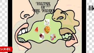 periodonticslectureoral MalodorHalitosisBad Breath [upl. by Selassie237]