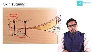 Suturing Techniques  Important topic for NEET PG  AIIMS  JIPMER  PGI exam [upl. by Ameh]