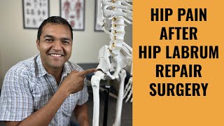 Top 5 Reasons For Hip Pain After A Hip Labrum Repair Surgery [upl. by Nij]