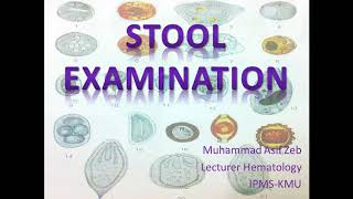 Stool examination interpretation and importance explained in hindiurdu [upl. by Airetnahs703]