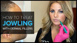 FAQ Bay Area Expert Shows How to Treat Jowls with Dermal Fillers [upl. by Myk]