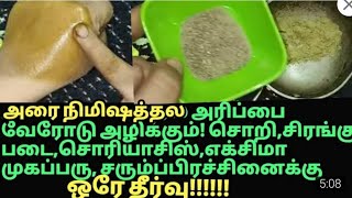 அரிப்பு அரிப்புஅரிப்பு இத்தனை நாள் இது தெரியாமப்போச்சே itchingpsoriasisskin disease home remedy [upl. by Leclair]