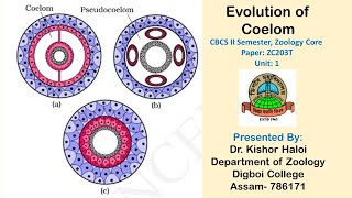 Body coelom  Body cavity  Acoelomate  Eucoelomate  Pseudocoelomate  Schizocoelom  Enterocoelom [upl. by Odraleba618]