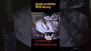 12weeks Ultrasound of baby boygender prediction nub theory shortsfeed reels [upl. by Airdnal]