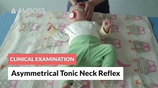 Asymmetrical Tonic Neck Reflex  Clinical Examination [upl. by Kassie]