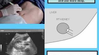 RUQ ultrasound protocol in Power Point [upl. by Lin]