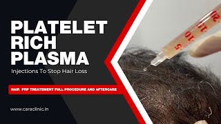 SideEffects of PlateletRich Plasma Therapy Cost amp Recovery  PRP Treatment Stop Hair Fall [upl. by Zelma557]