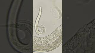 Phylum Aschelminthes Nematoda Roundworms [upl. by Noiztneb319]