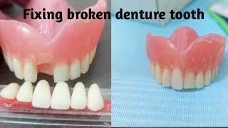 How to fix broken denture tooth [upl. by Eellek]