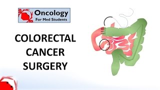 Colorectal Cancer Surgery principles and types [upl. by Vivica]